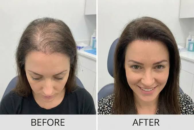 hair fall oil for women's