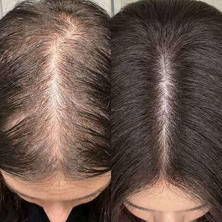 hair fall oil for women's